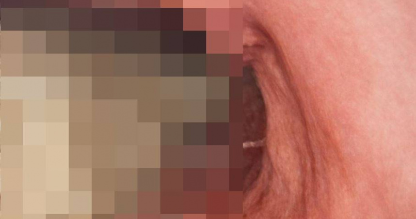 患者因上腹嚴重脹痛就醫，即使已空腹12小時，胃鏡檢查時仍發現胃與十二指腸內殘留大量食物。（圖／翻攝自臉書，吃病）