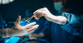 英國1名外科醫師因手術嚴重失誤，誤將病患的小腸與胃錯誤縫合。（示意圖／unsplash）