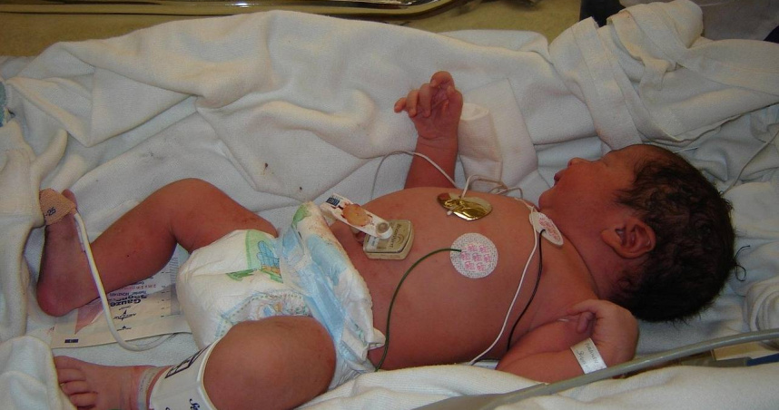 網路流傳的「醋酸鉛濕敷法」被誤用於護膚，導致母女中毒，凸顯網紅偏方的危險性。（示意圖／Pixabay）