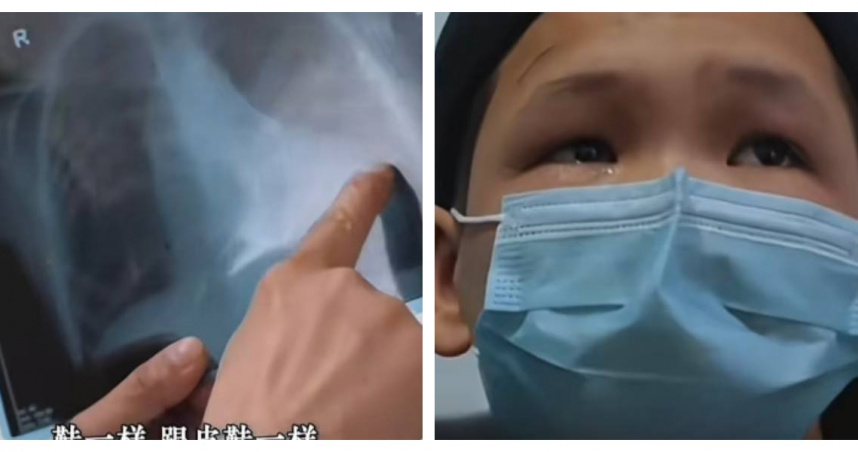 盧克曼因心臟異常嚴重變形，術後成功恢復健康」。（圖／翻攝自都市報導）