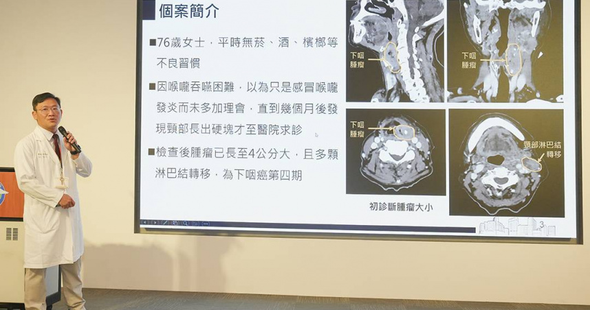 76歲嬤第四期下咽癌免切喉，保留聲音重拾昔日歌喉。（圖／中國醫藥大學附設醫院）