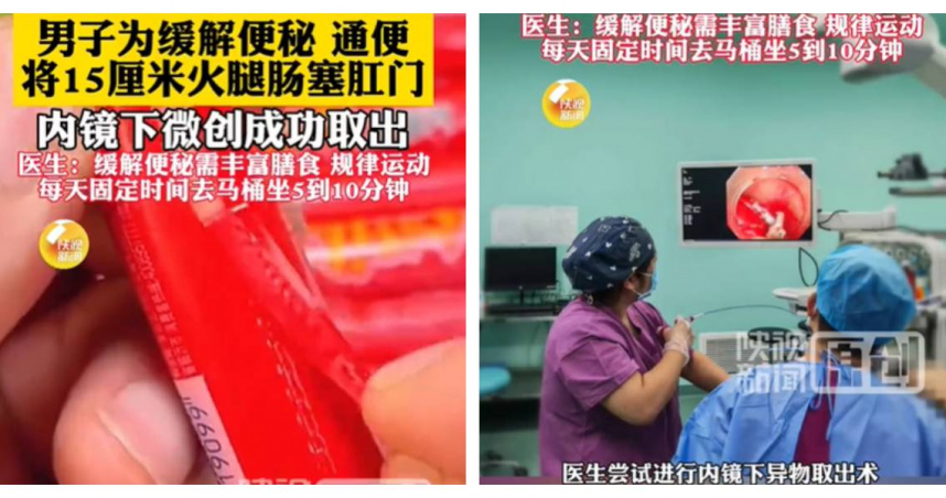 男子為通便使用火腿腸，最終需進行內視鏡手術取出。（圖／翻攝自微博）