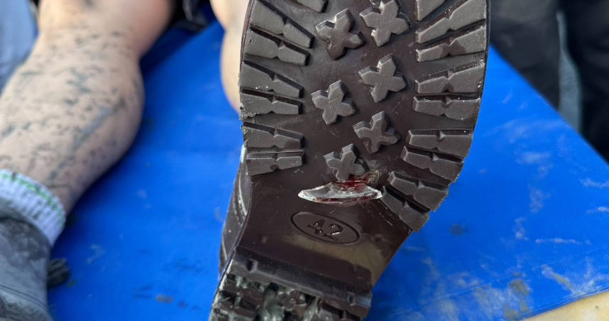 災後重建外科醫療需求增大，花蓮慈院3＋1＋N醫療支援不間斷。（圖／花蓮慈濟醫院提供）