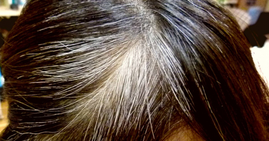 孫語霙指出，多吃牛肉、雞肉、豬肉等，可攝取製造黑色素的原料「酪胺酸」。（示意圖／photoAC）