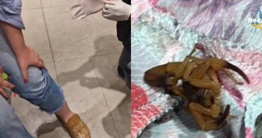 巴西一名女大生在試衣間遭到蠍子咬傷。（圖／翻攝自Instagram）