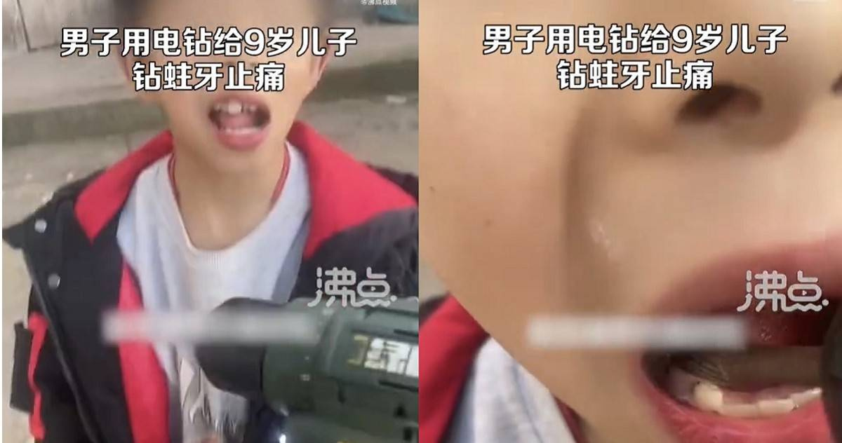 A 9yearold boy has a toothache... Dad actually "uses an electric