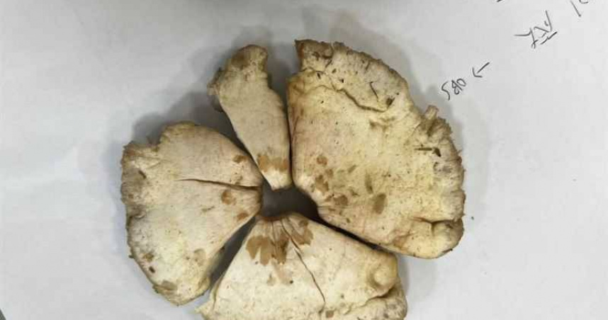 民眾自行野外採摘，誤將有毒蕈類當作可食用品種，其中以綠褶菇最常見。（圖／台北榮總提供）