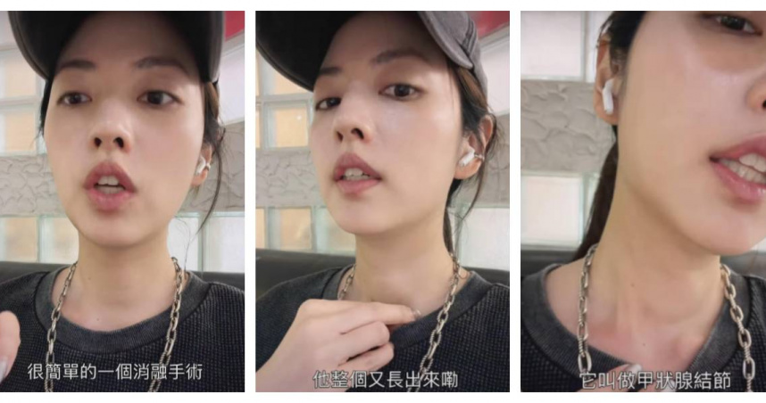 脖子那顆被狂提醒！阿諾認了長腫瘤　2週後動手術