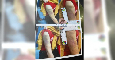 補教老師失控!男童喊三聲「老師」竟遭狂打 補習班:已解雇老師並負全責