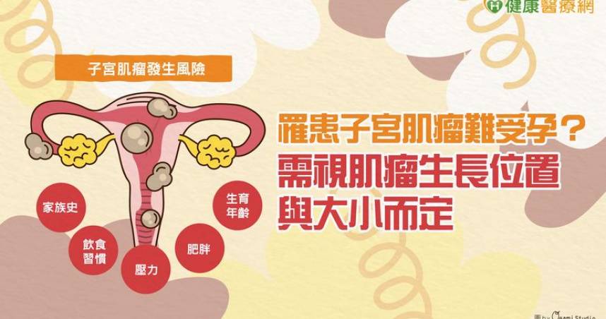 子宮肌瘤與家族史有關　醫師：後天因素亦需留意