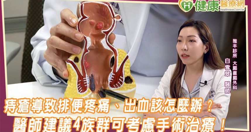 痔瘡導致排便疼痛、出血該怎麼辦？　醫師建議4族群可考慮手術治療！