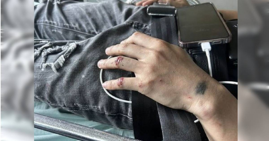 范姓男移工騎機車過彎失控,不慎自撞護欄受擦挫傷,在原地待救3小時後才送醫。(圖/翻攝畫面)