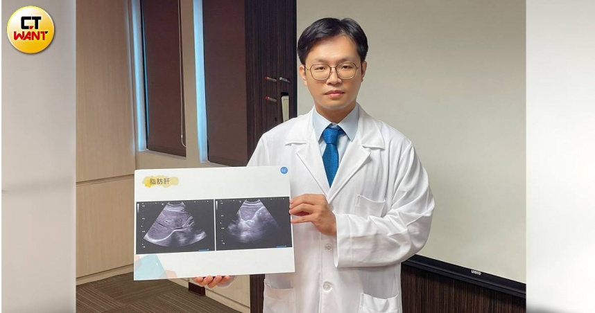 書田診所胃腸肝膽科主任醫師康本初提醒，喝酒過度小心酒精性肝病上身。（圖／林則澄攝）