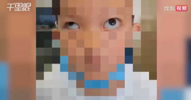6歲男童模仿App凸眼特效 竟「徒手挖眼球」…左眼外凸險失明