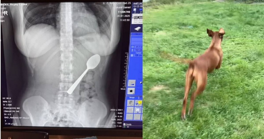 比利時一名28歲女子艾美琳克斯誤吞17公分長的湯匙，所幸經內視鏡手術順利取出，沒有造成永久傷害。（圖／翻攝自Instagram／reymyamelinckx）