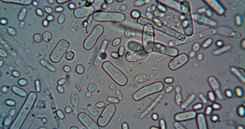 世界衛生組織已將病例樣本送往剛果首都金沙薩的國家生物醫學研究所進行檢測。（示意圖／翻攝Pexels）