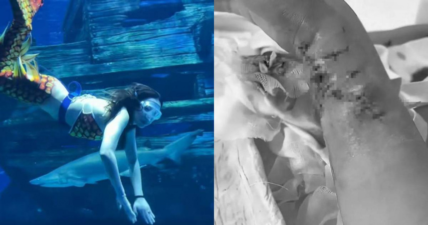 大陸1名李姓女子2023年為參加「美人魚大賽」，到海洋館訓練時突遭鯊魚咬手。（圖／翻攝自揚子晚報）