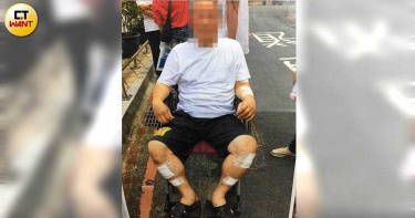 【監委很賣力3】幫朋友出氣 黑衣人將住戶打到坐輪椅