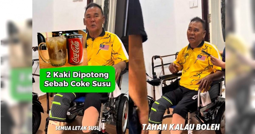 馬來西亞一名中年男子長期飲用汽水加煉乳，導致糖尿病惡化，最終面臨截肢。（圖／翻攝自TikTok／kedidi_kakipalsu）