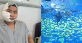 大陸一名包姓男子體驗潛水時遭沙虎鯊咬傷頭部及臉部。（圖／翻攝微博）