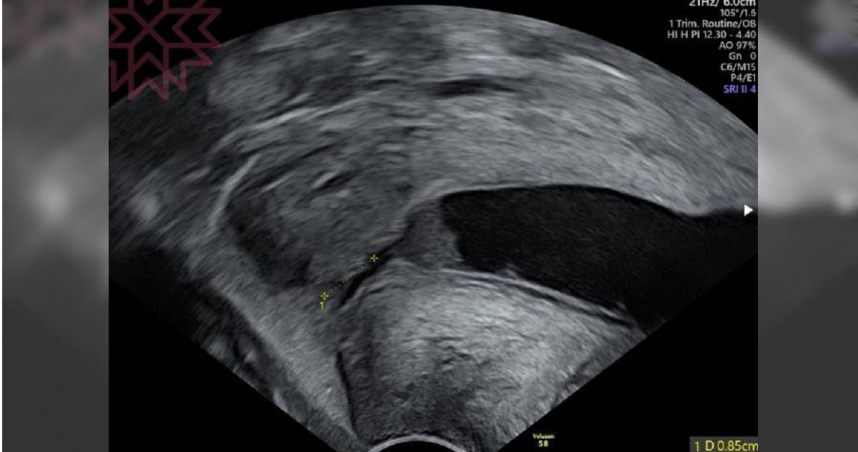 知名婦產科醫師蘇怡寧近日分享了一則驚險案例。（圖／翻攝自蘇怡寧臉書）