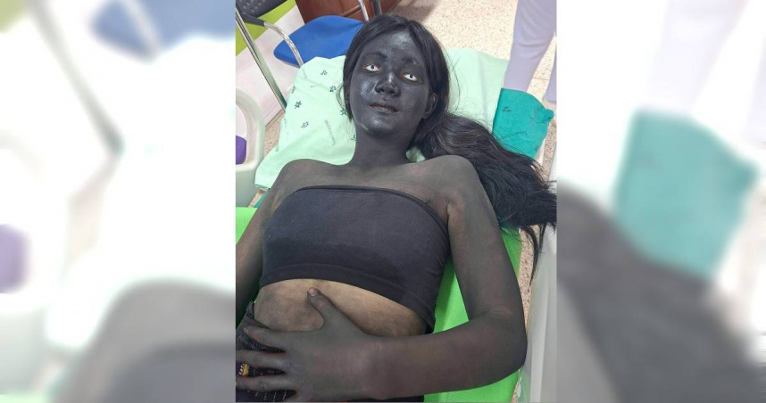 泰國一名16歲女學生日前因腹痛緊急送醫，沒想到她當時仍頂著鬼怪妝容，讓前來救援的救護人員及醫院醫護人員全都嚇了一跳。（圖／翻攝自臉書，泰國清邁象 Chiang Mai Elephant﻿）