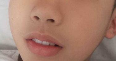 媽媽我好睏!8歲男童打呼超大聲「愈長愈醜」 檢查結果嚴重了