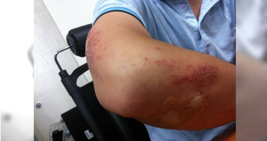 美國主持人在直播節目中接受皮膚科醫師檢查，卻當場確診癌症。（示意圖／Pixabay）