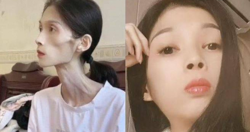 幾年前的巧巧還是一位容貌出眾、氣質溫婉的女子，與如今這副枯槁的模樣判若兩人。（圖／翻攝自微博）