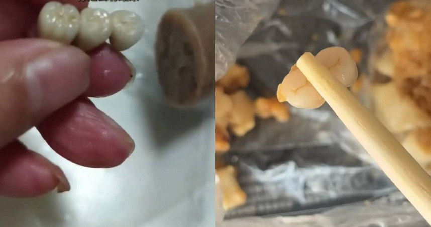 大陸近期有不只一位民眾在食物中吃出牙齒。（圖／翻攝自星島日報）
