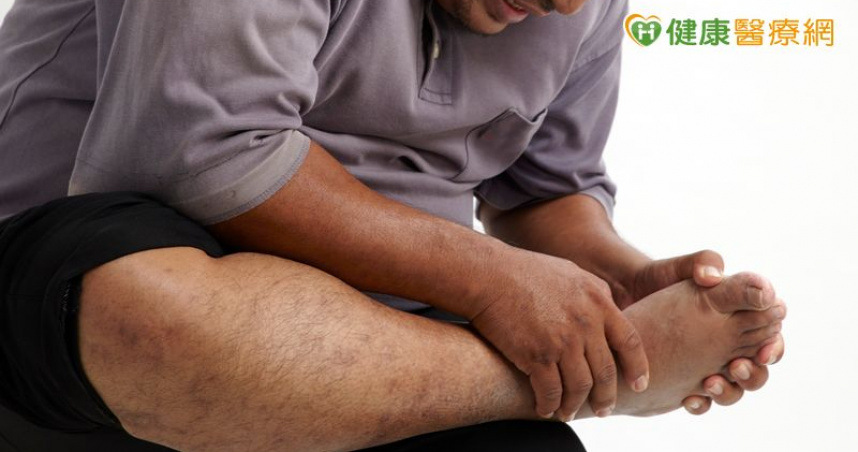 急性期先止痛　長期控制尿酸才是關鍵