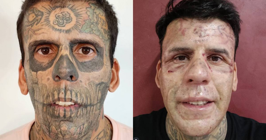 全身擁有95%面積刺青的利安德羅德蘇薩信奉宗教後，決定洗掉刺青。（圖／翻攝自IG／Leandro de Souza）