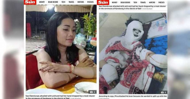 不甘女友提分手…恐怖情人「剁下左手掌+潑酸毀容」 逃亡18個月終落網