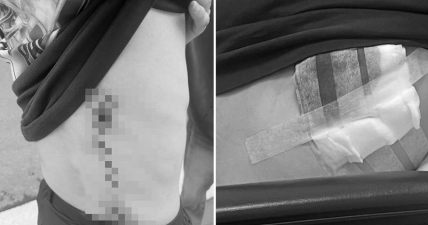 韓國留學生遭陌生人砍傷。（圖／翻攝自Threads@chalongwu）