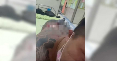 含羞草日記副團長「超艾夾」遭砍傷 警帶回1關係人釐清案情