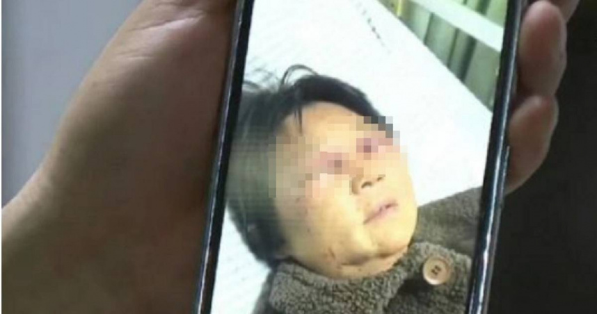 大陸浙江驚傳媳婦毆打婆婆的駭人事件，受害婆婆甚至被打斷4根肋骨。（圖／翻攝自微博／瀟湘晨報）