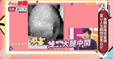 68歲婦內褲常見血 醫檢查:一脫褲子「掉出整顆子宮」