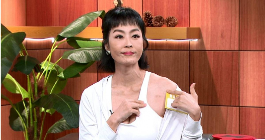 唐玲左肩的人工血管已取出，樂觀表示疤痕是戰勝病魔的光榮印記。（圖／年代提供）