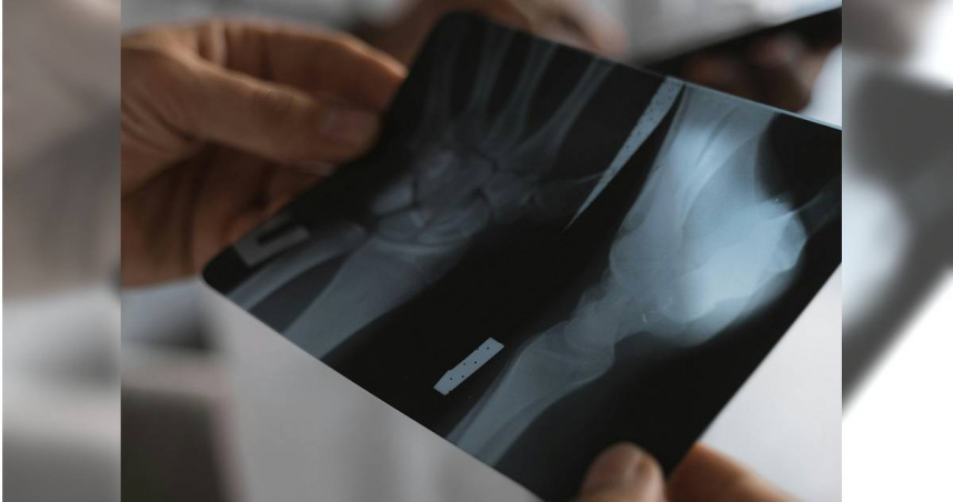 醫師表示，作息不規律，骨折機率增加。（示意圖／Pexels）