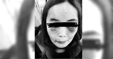 丈夫痛毆軟禁妻子還揚言「殺岳父」 民代彭佳芸伸援手