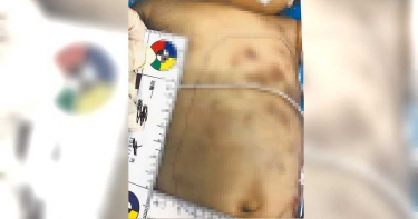 這麼小也打得下去? 台南狠父痛毆1月大男嬰遭起訴