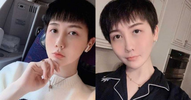 蛇精男消失3個月近況公開 「全臉毀容」崩潰:不知如何面對以後的生活