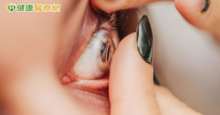 隱形眼鏡戴超時　恐致角膜潰瘍