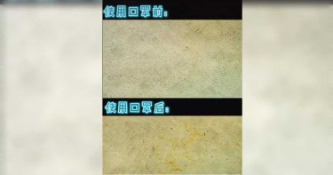 使用過的口罩放大2000倍 驚見超多細菌逛大街