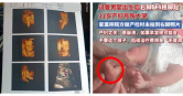 試管男嬰右足缺4趾，家屬質疑產檢未示警。（圖／翻攝自封面新聞）