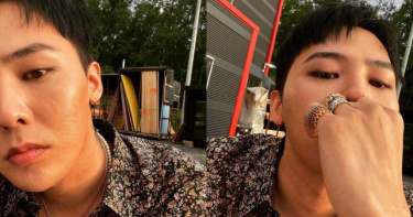 GD曬零修圖自拍照!曝真實膚況「滿臉爛痘」…濃厚底妝也遮不住