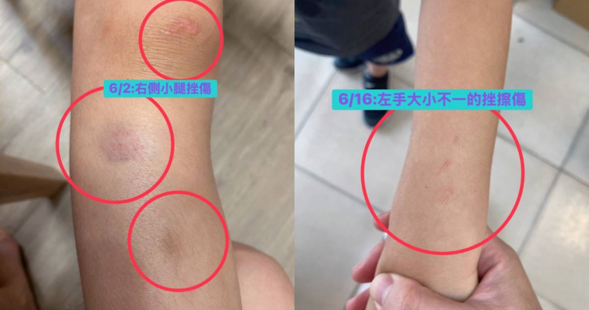 桃園市某國小驚傳校園霸凌。（圖／翻攝自臉書／黃瓊慧 桃園觀察日記）