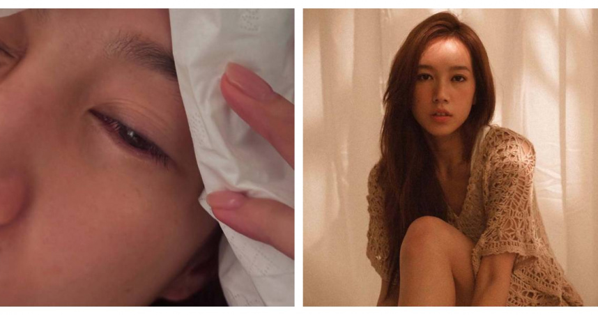 傅嘉莉在IG自述眼角膜受傷，直言只能用蠢來形容自己，引起粉絲關注。（圖／擷取自IG，@kelly.fuu）