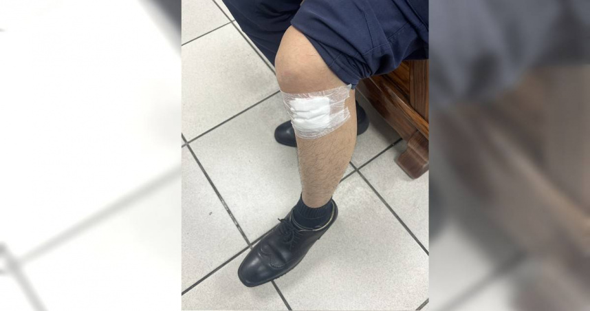 毒駕遇攔檢竟衝撞2員警逃逸　警掌握犯嫌身分追緝中　