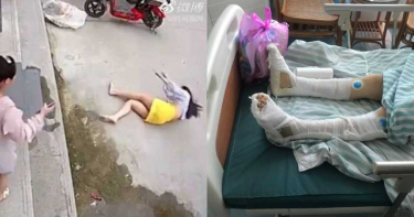 溫柔尪結婚1年變惡魔!辣妻不堪虐打「跳樓求生」…雪白長腿慘廢了
